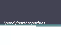 Spondyloarthropathies Spondyloarthropathias