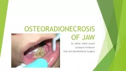 OSTEORADIONECROSIS OF JAW