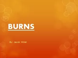 BURNS By: Jacob Miller WHAT ARE BURNS?