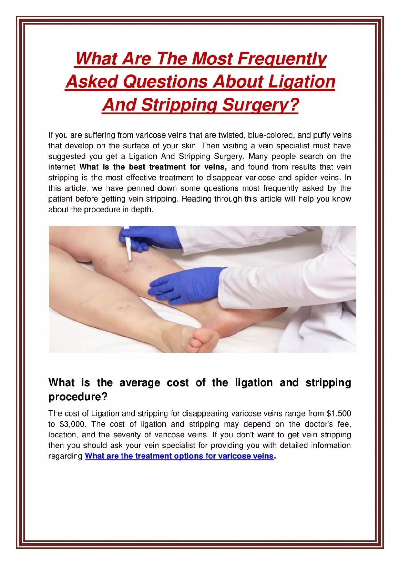 What Are The Most Frequently Asked Questions About Ligation And Stripping Surgery?
