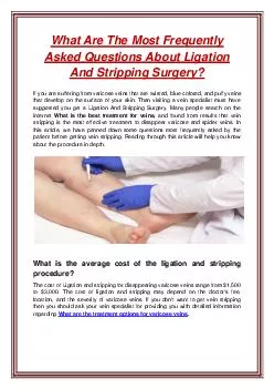 What Are The Most Frequently Asked Questions About Ligation And Stripping Surgery?