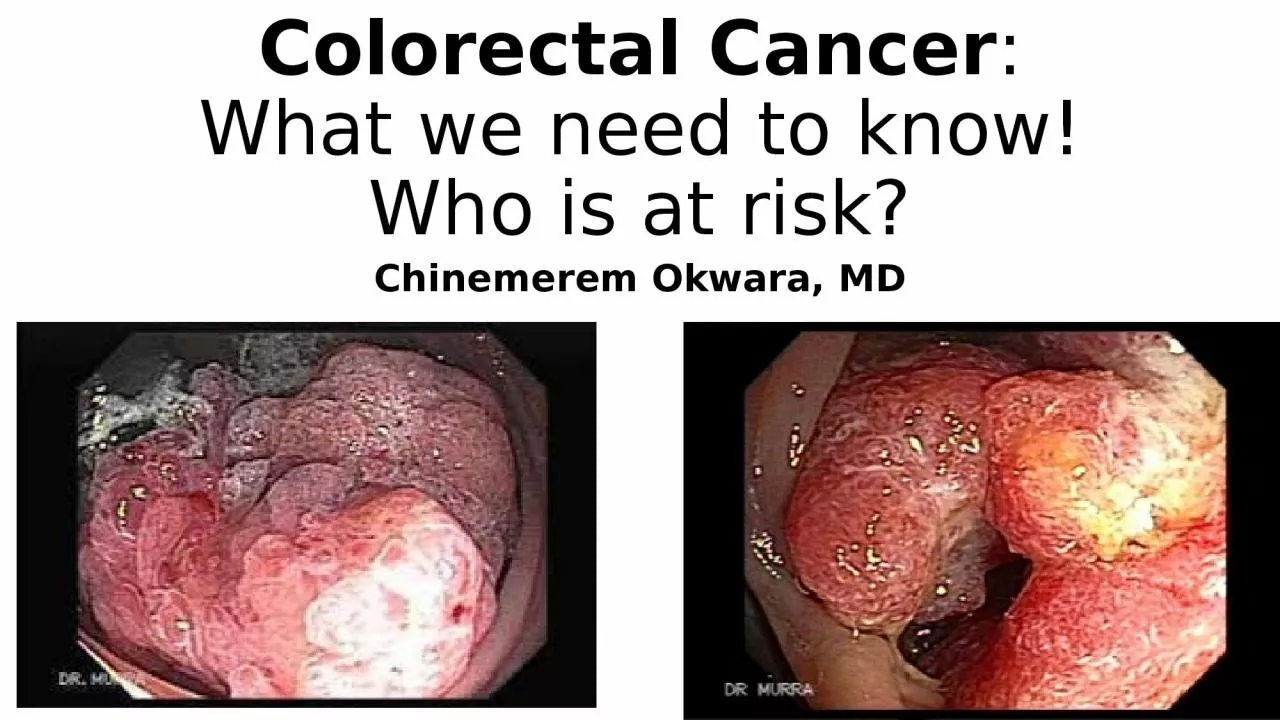 Colorectal Cancer : What we need to know! Who is at risk?