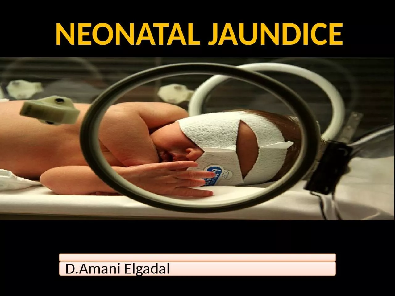 PPT-NEONATAL JAUNDICE WWW.SMSO.NET