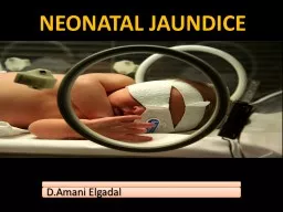 NEONATAL  JAUNDICE WWW.SMSO.NET