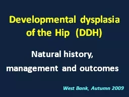 Developmental dysplasia