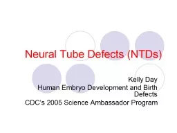 Neural Tube  Defects (NTDs)