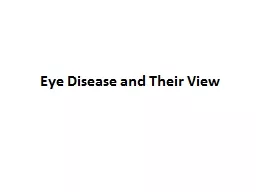 PPT-Eye Disease and Their View