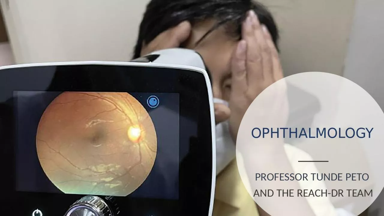 PPT-OPHTHALMOLOGY PROFESSOR TUNDE PETO