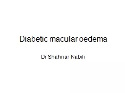 Diabetic macular oedema Dr Shahriar Nabili