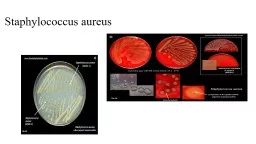 Staphylococcus aureus General Features