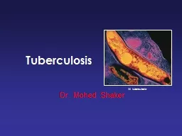 Tuberculosis   M. tuberculosis