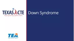 Down Syndrome Down syndrome