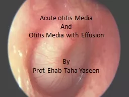 Acute otitis Media And Otitis Media with Effusion