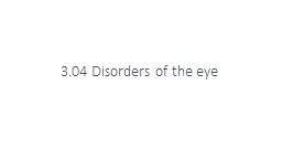 3.04 Disorders of the eye