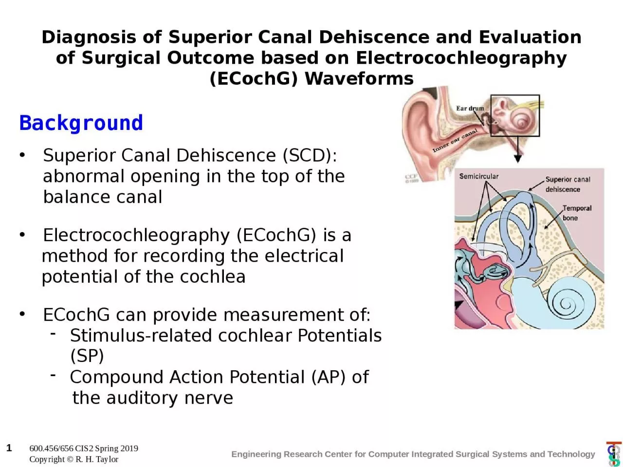 Diagnosis of Superior Canal D
