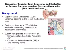 Diagnosis of Superior Canal D