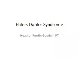 Ehlers  Danlos  Syndrome