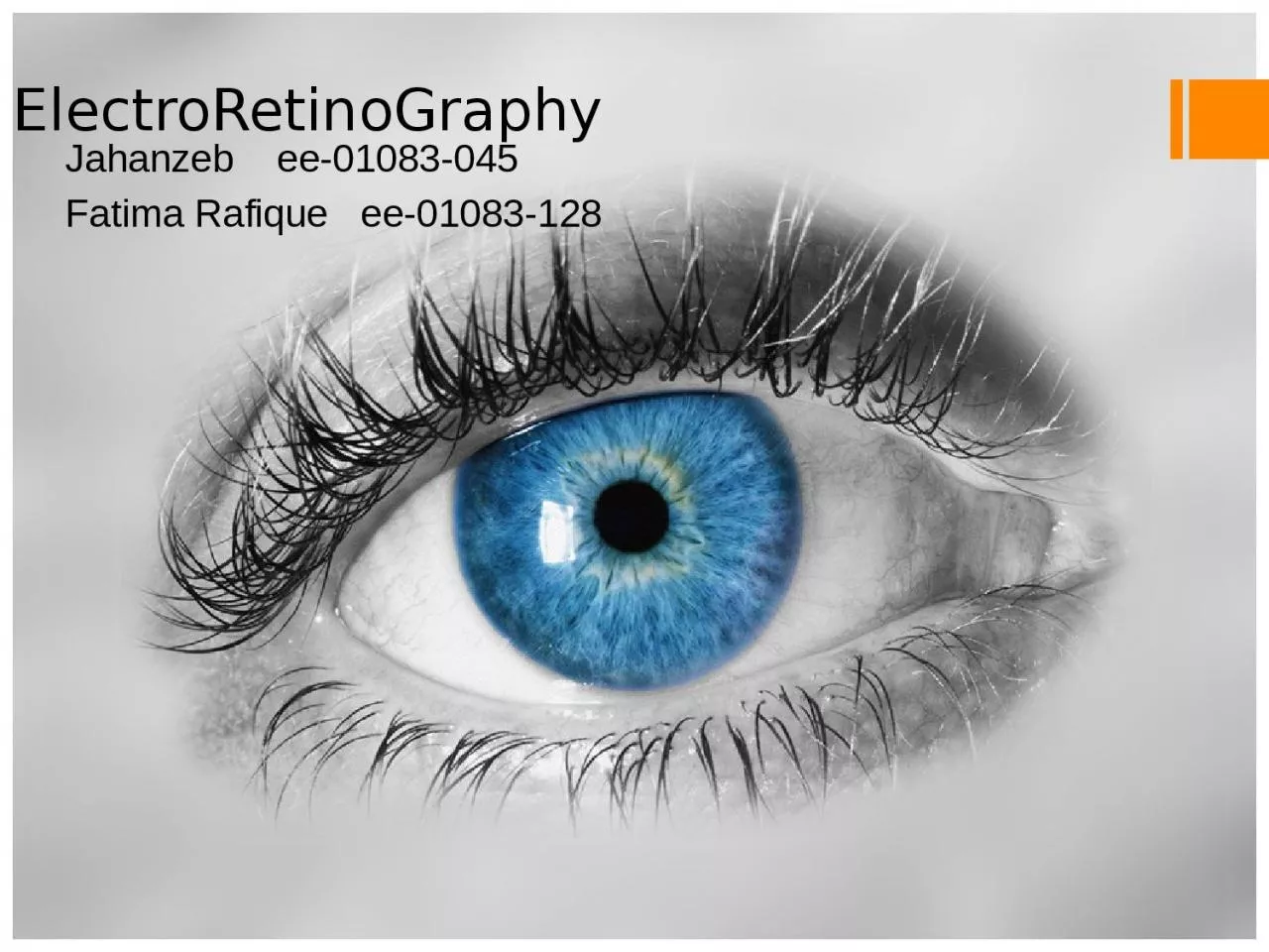 PPT-ElectroRetinoGraphy Jahanzeb