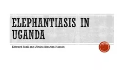 Elephantiasis IN UGANDA Edward