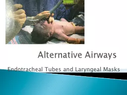Alternative Airways Endotracheal Tubes and Laryngeal Masks