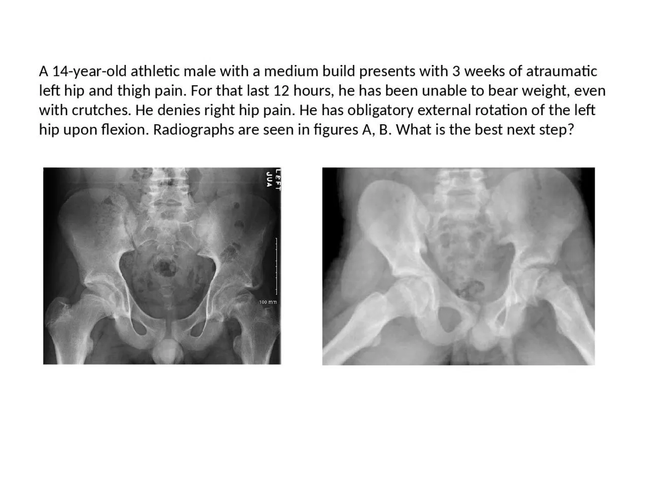 PPT-A 14-year-old athletic male with a medium build presents