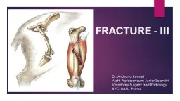 FRACTURE - III . Dr. Archana