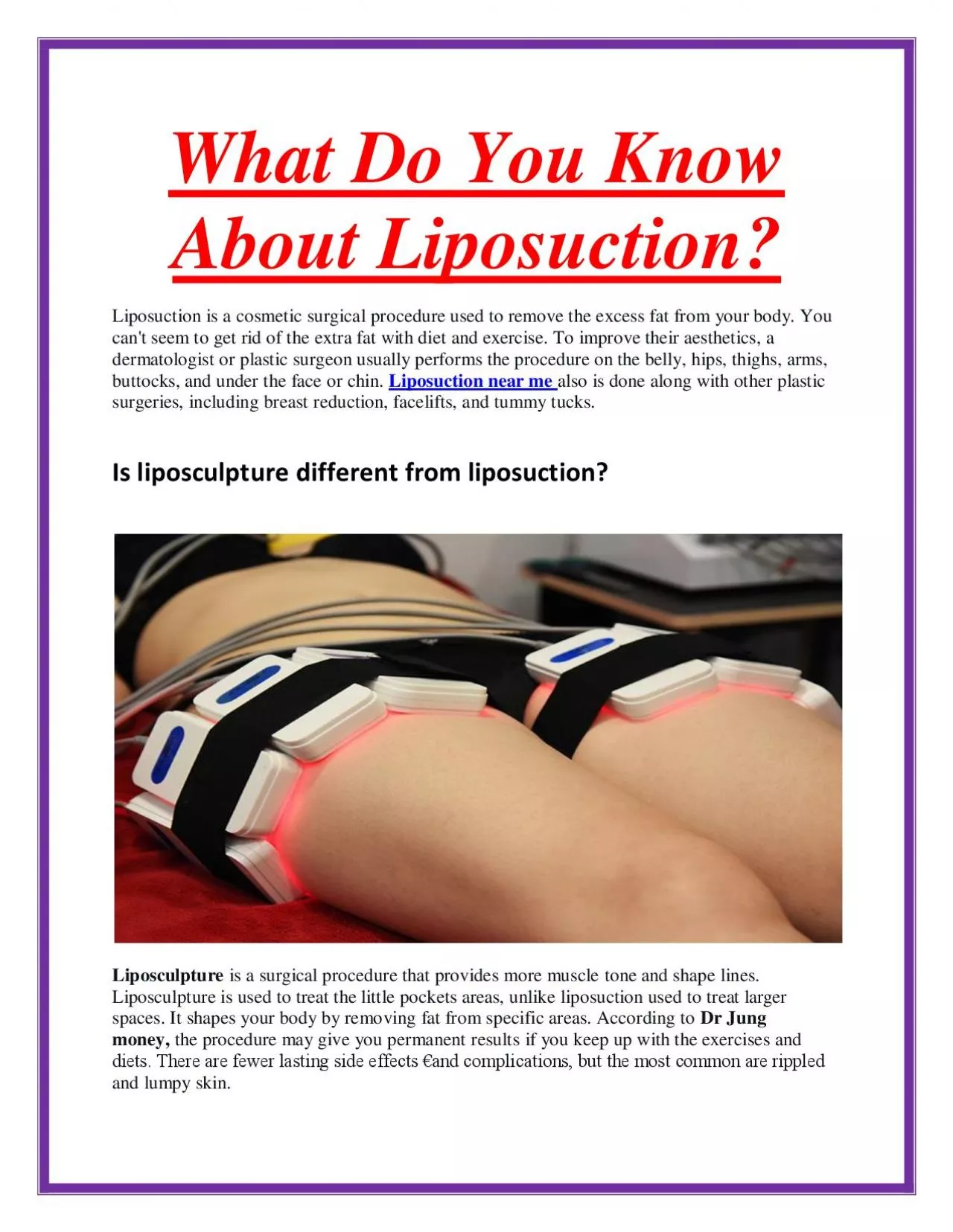 What Do You Know About Liposuction?
