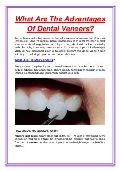 What Are The Advantages Of Dental Veneers?