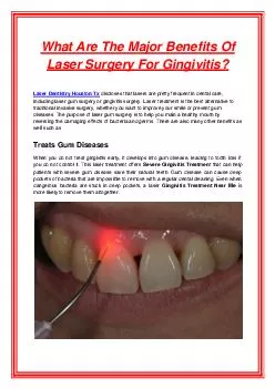 What Are The Major Benefits Of Laser Surgery For Gingivitis?