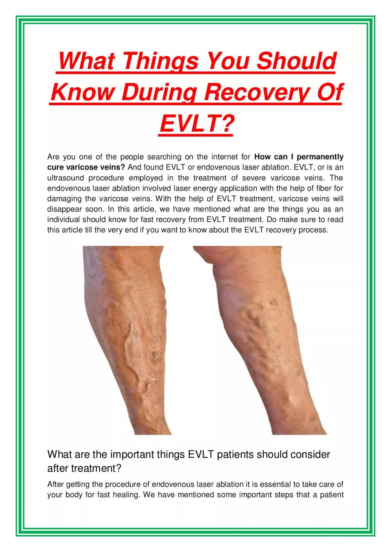 What Things You Should Know During Recovery Of EVLT?