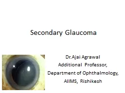 Secondary Glaucoma Dr.Ajai