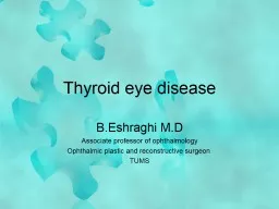 Thyroid eye disease B.Eshraghi