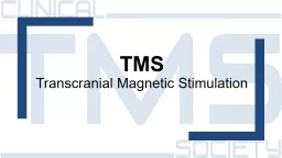 TMS   Transcranial Magnetic Stimulation