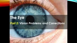 The Eye Part 2:  Vision Problems and Corrections