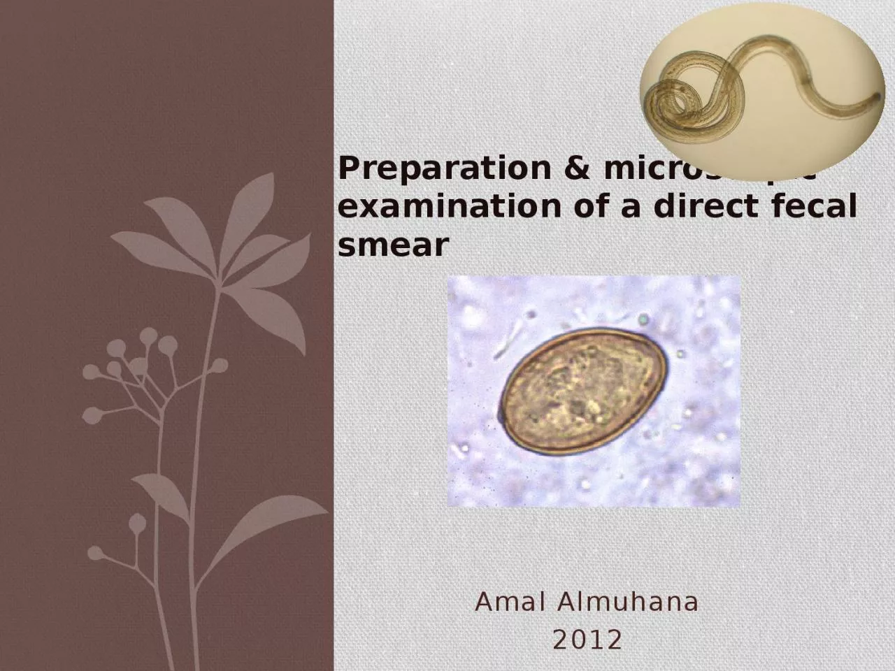 PPT-Amal Almuhana 2012 Preparation & microscopic examination of a direct fecal smear