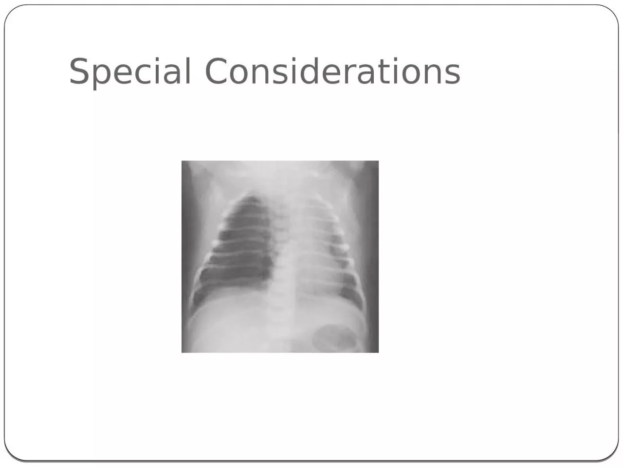 PPT-Special Considerations Objectives