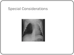 Special Considerations  Objectives