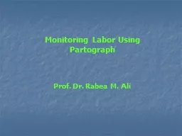 Monitoring Labor Using  Partograph