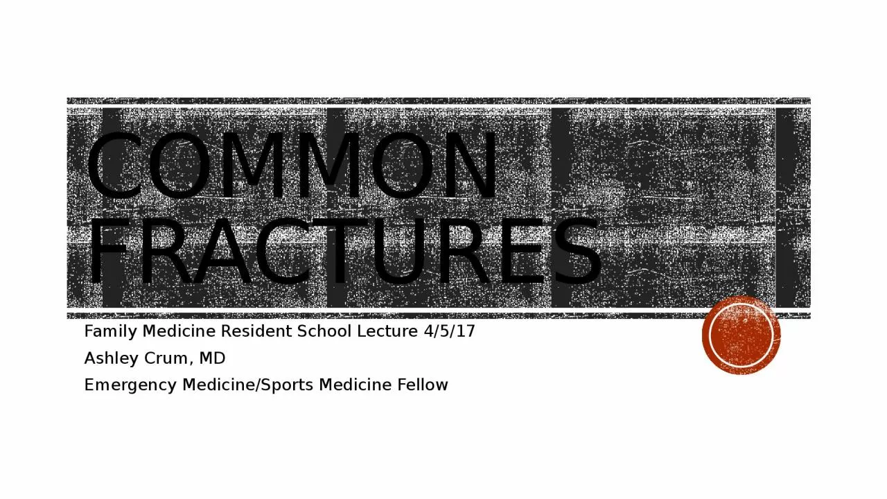 Common Fractures Family Medicine Resident School Lecture 4/5/17