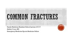 Common Fractures Family Medicine Resident School Lecture 4/5/17