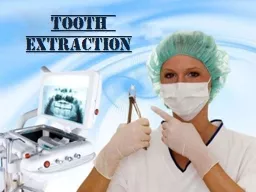 Tooth extraction Mechanical principles of