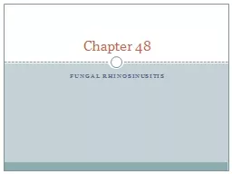 Fungal  Rhinosinusitis Chapter 48