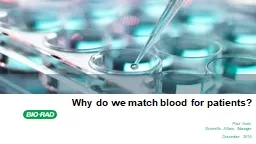 Why do we match blood for patients?