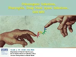 Odontogenic Infections,