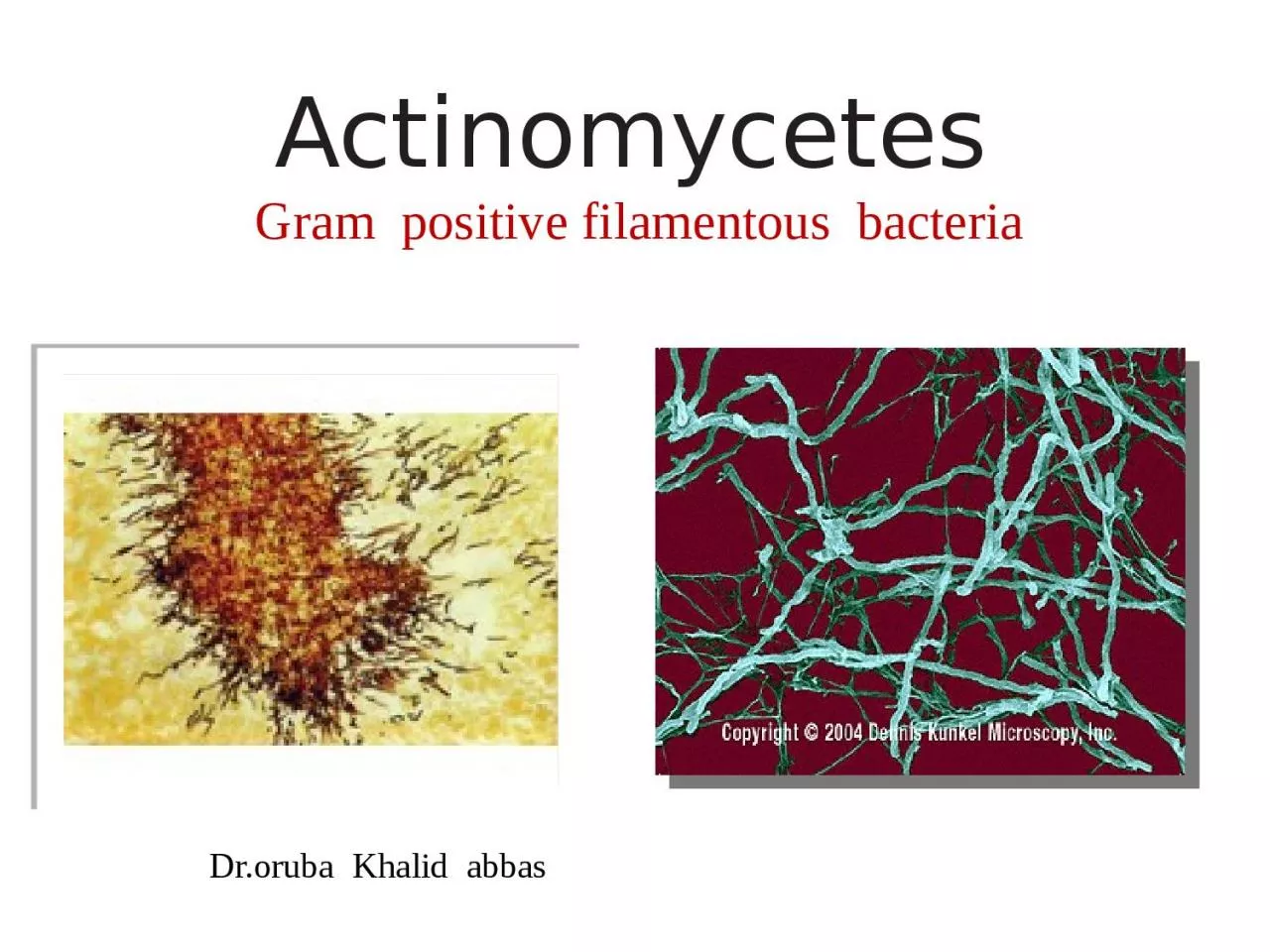 PPT-Actinomycetes Gram positive filamentous bacteria