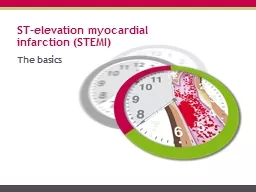 ST-elevation myocardial