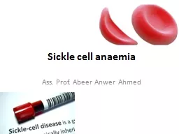 Sickle cell  anaemia Ass. Prof.