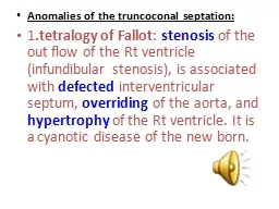 Anomalies of the  truncoconal