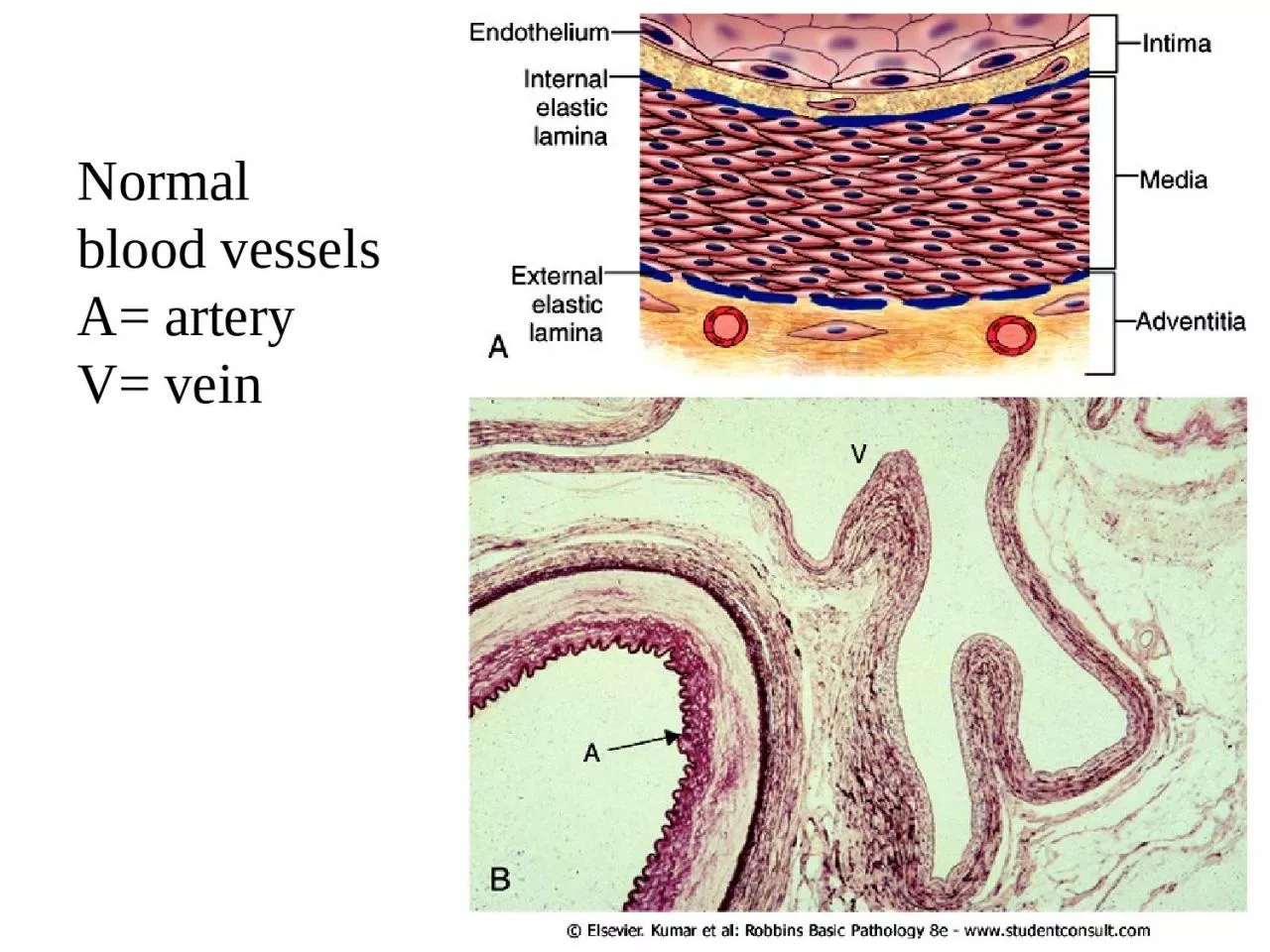 PPT-Normal blood vessels A= artery