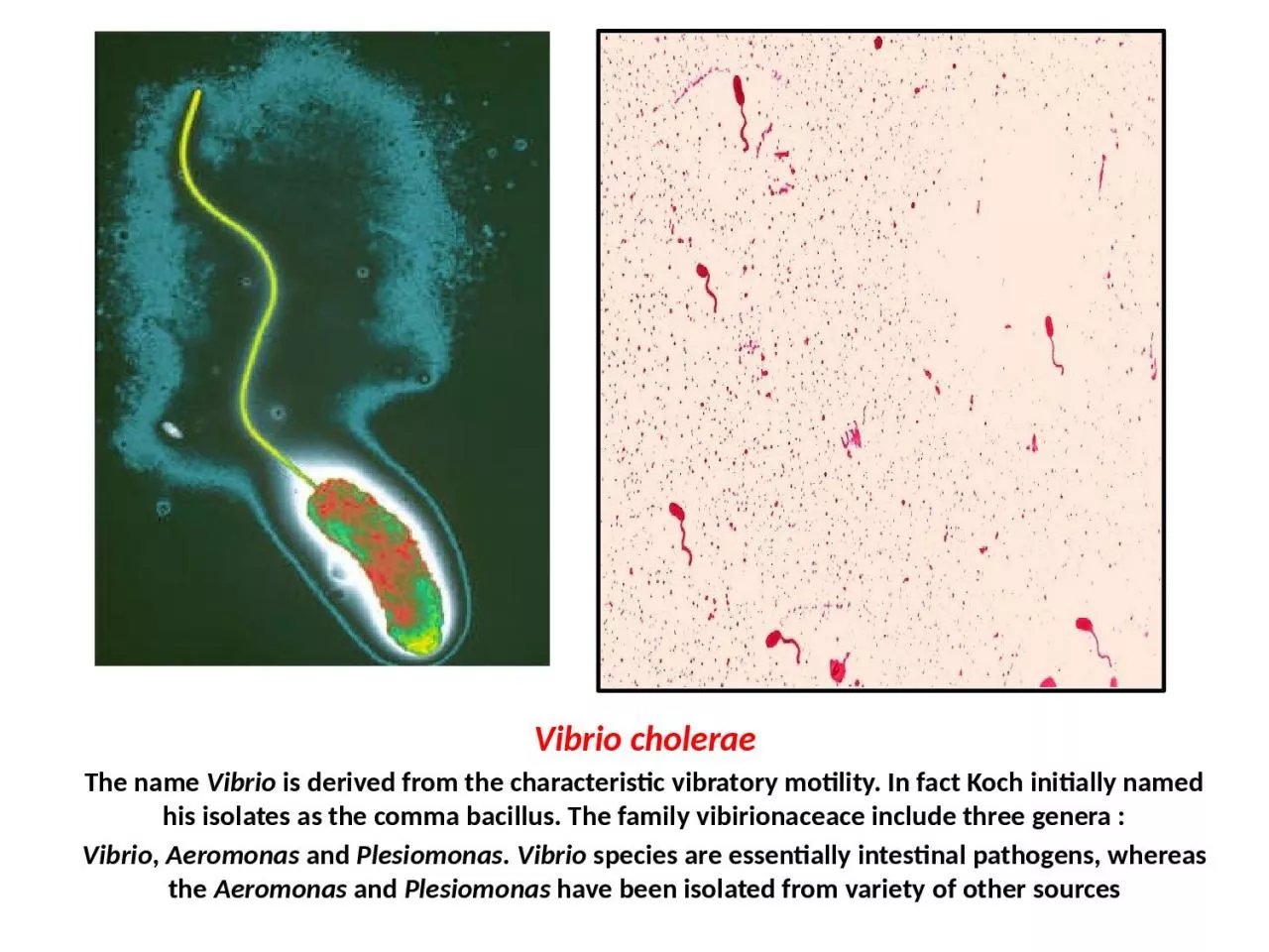 Vibrio  cholerae The name